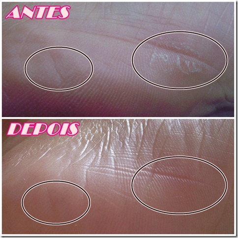antes e depois1