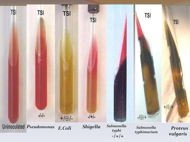 Triple Sugar Iron (TSI) test