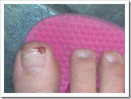 toe