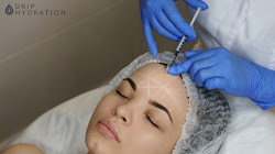 Tiêm botox xóa nhăn trán có hiệu quả không?