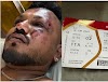चमत्कार! एयर इंडिया विमान हादसे में जिंदा बच गया एक शख्स, बोला- जब मैं उठा तो मेरे चारों ओर...