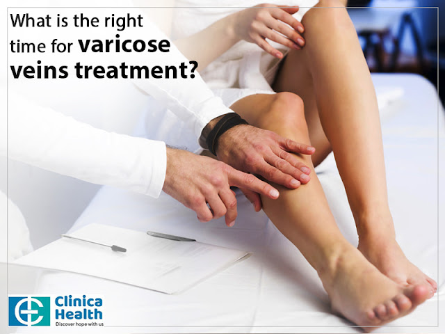 Varicose veins laser treatment in Kolkata