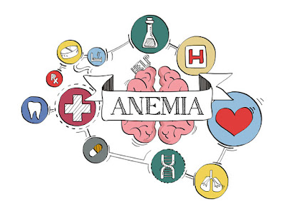 Treatment of Iron Deficiency Anaemia With The Natural Hematinic Carbaodeim