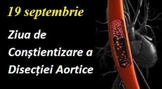 19 septembrie: Ziua de Conștientizare a Disecției Aortice