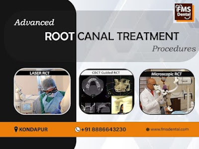 Best Root Canal treatment clinic in Kondapur