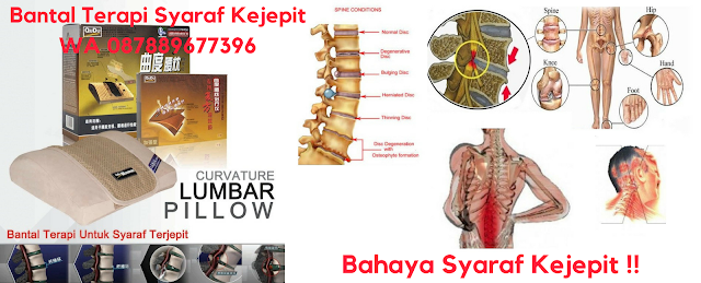 Syaraf Kejepit Lumbal, Syaraf Kejepit Obat Herbal, Syaraf Kejepit Lumpuh