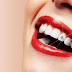 Đính đá răng là gì?