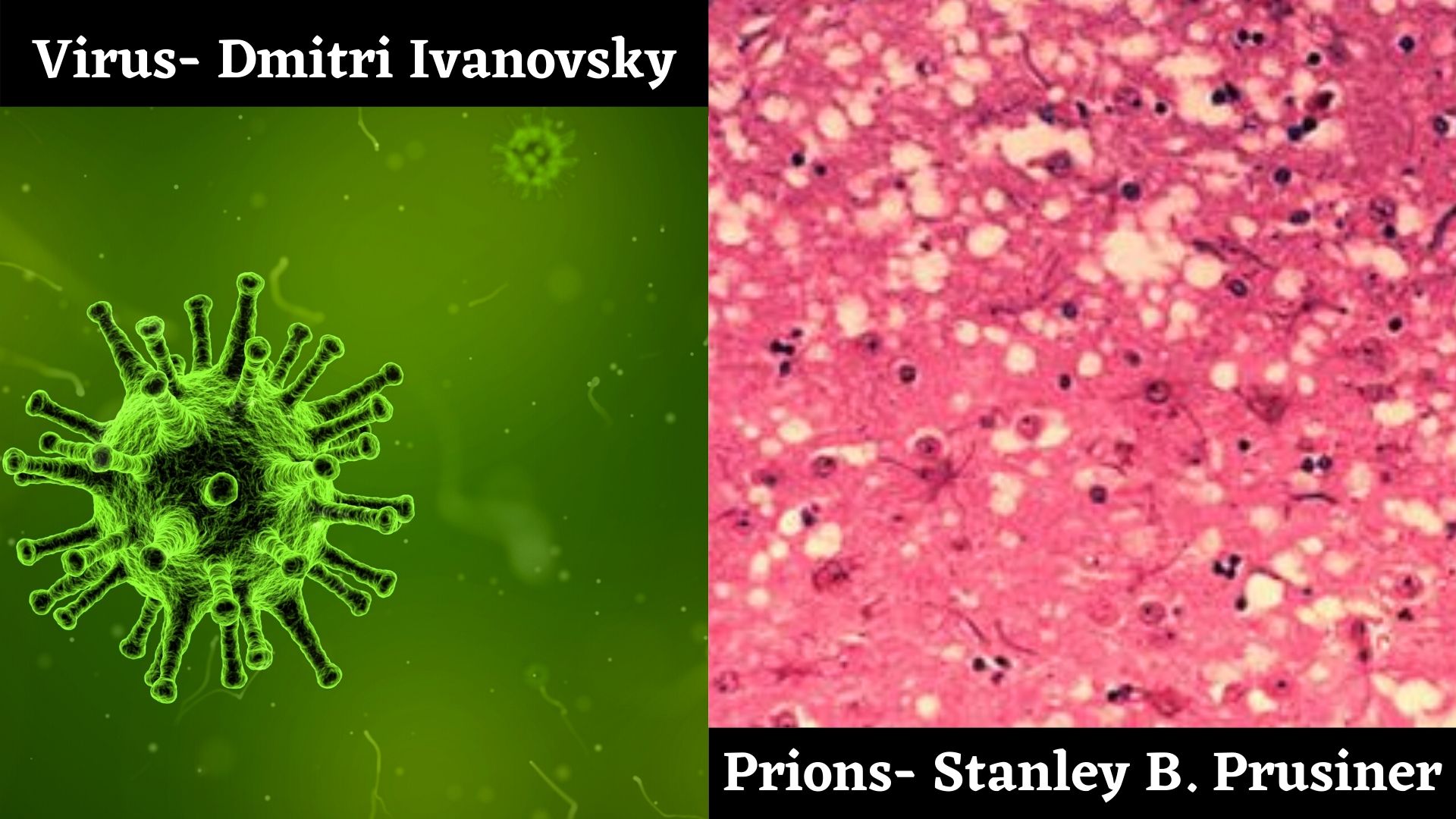 Virus and Prions