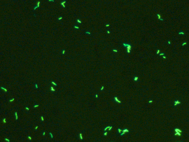 Tubercle bacilli with fluorescent dye