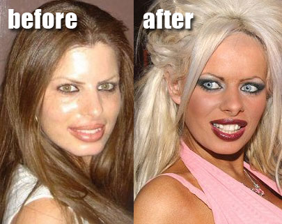 Orit Fux before and after plastic surgery.