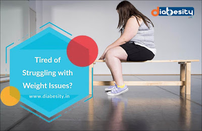 weight loss surgery delhi