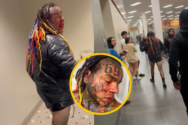 JUST IN: 6ix9ine was severely beaten up in an ambush attack at a gym sauna, rushed to hospital