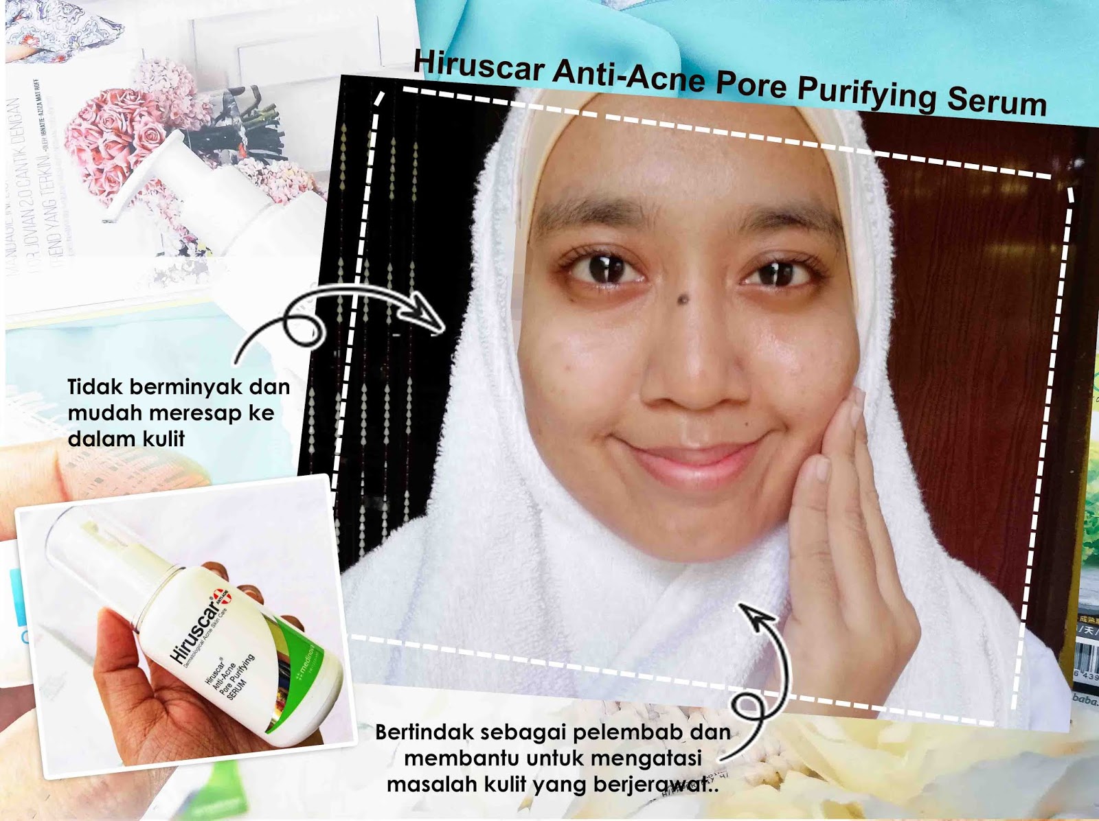 Hiruscar Anti Acne Untuk Masalah Jerawat Zaza Iman Lifestyle Blogger