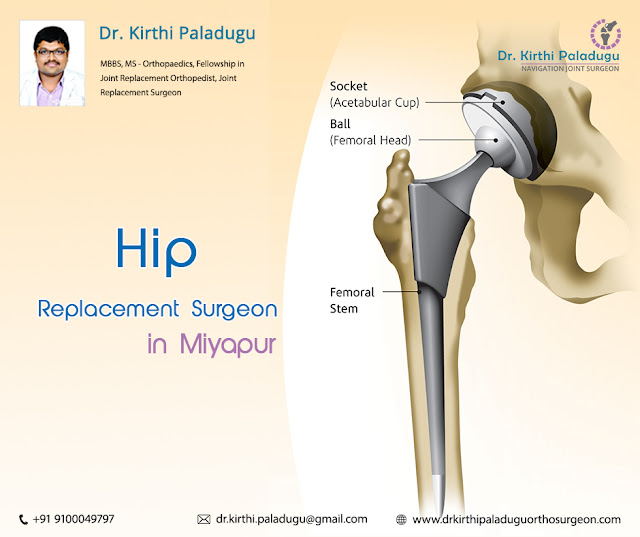  Hip Replacement Surgeon in Miyapur