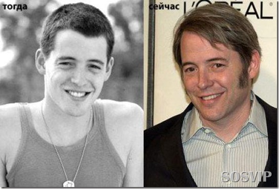 Celebridades antes e depois - Celebs before after.jpg (15)