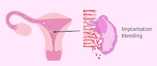 What does implantation bleeding look like