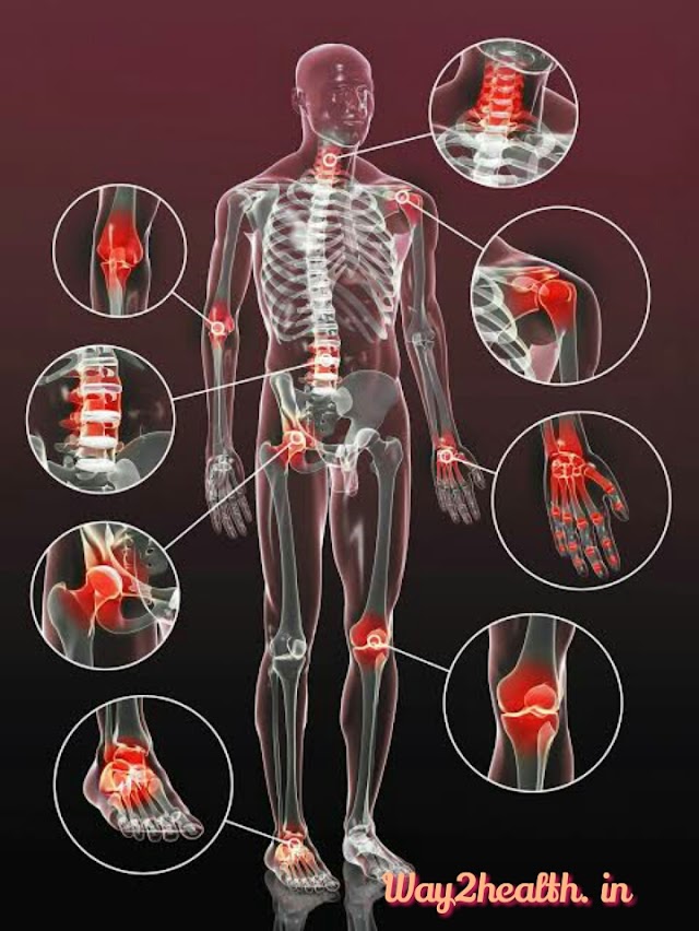 Osteoarthritis -   know the  possible causative factors and how to get rid from joint pain by some home remedies and lifestyle changes 