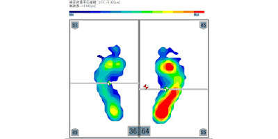 足圧バランス測定