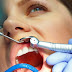 Cạo vôi răng có hại không? Có tác động tới men răng?