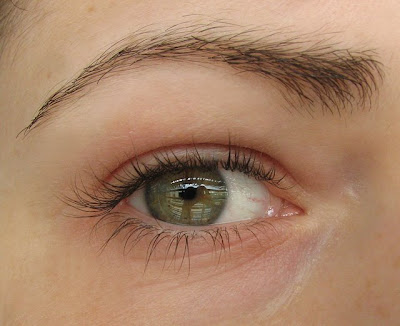 Here is a before picture of my eye, without makeup and digital retouching of 