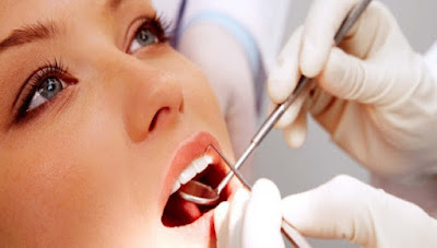 Tẩy trắng răng laser whitening