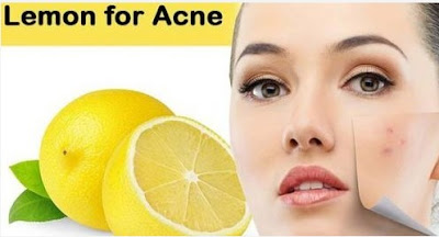 lemon for acne