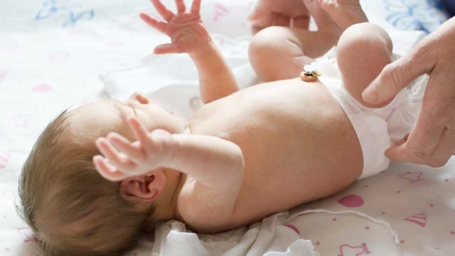 Cara Mengobati Hernia Pada Bayi Secara Alami & Terbukti Ampuh