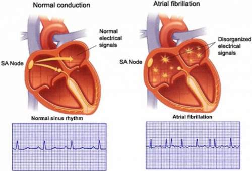 Blood Pressure Regulation