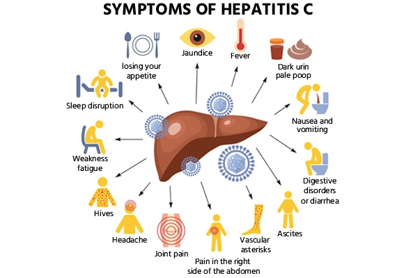 Causes, Symptoms, Treatment, and Diagnosis of Hepatitis C