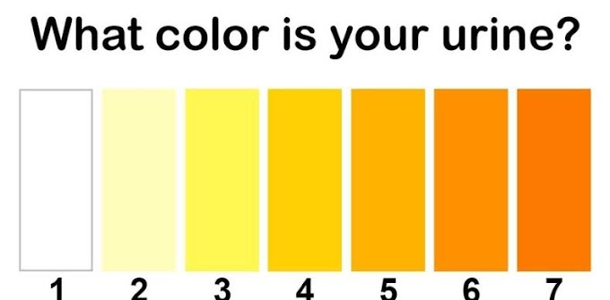 WHAT THE COLOR OF YOUR URINE SAYS ABOUT YOUR HEALTH !!!