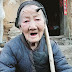 Nenek 101 tahun ada tanduk di dahi