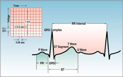 ECG Interpretation