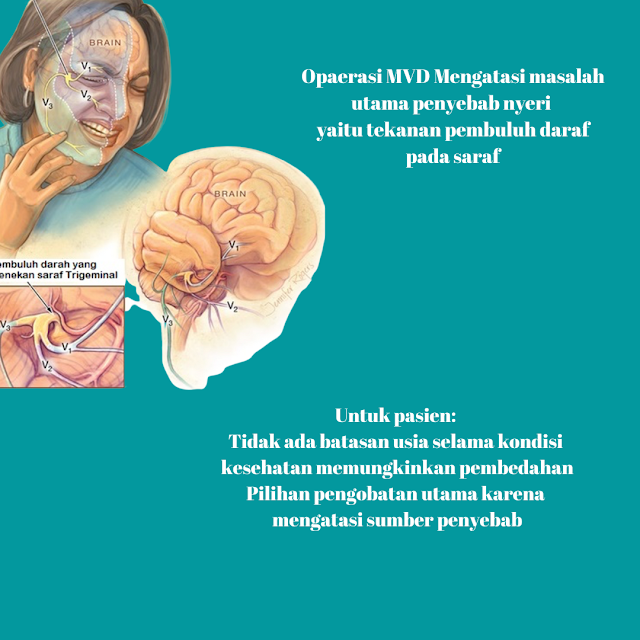 operasi MVD is happy surgery