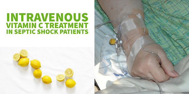 Intravenous Vitamin C Treatment - Sepsis