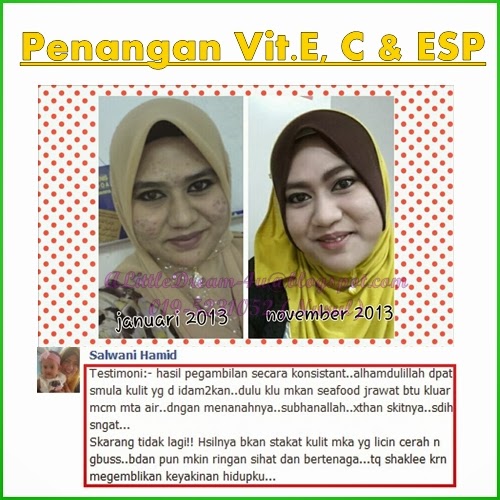 Set Kecantikan Kulit (Set D) untuk Wajah Cantik berseri