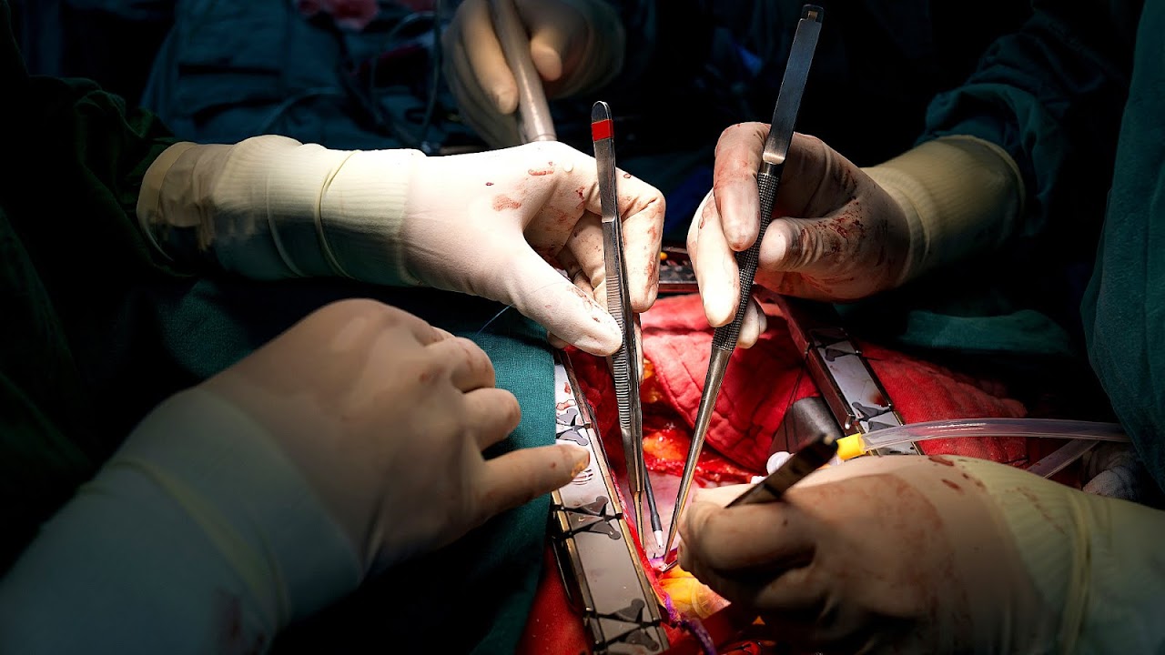 Open Heart Surgery Risk Of Death