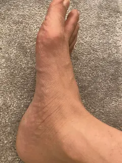 Dermatologist Riyadh امراض جلدية دكتور
