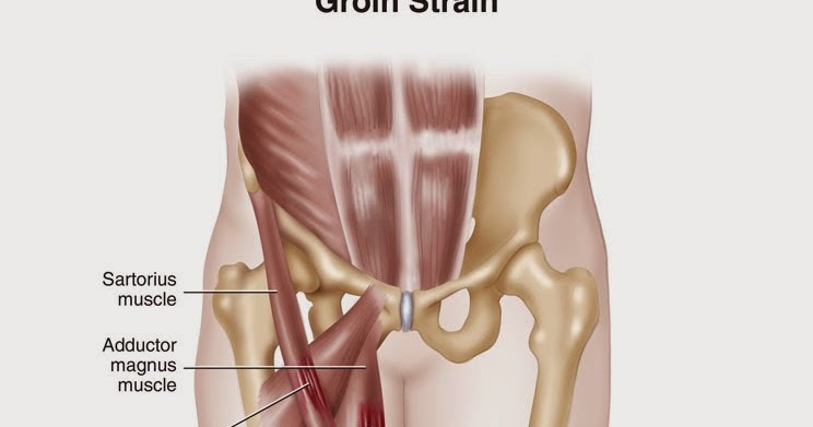 Terapi Sukan: Groin