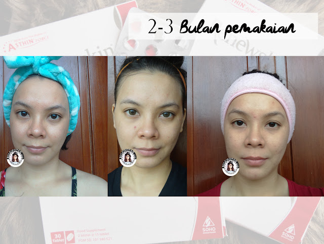 Renewskin+suplemen+kulit+wanita