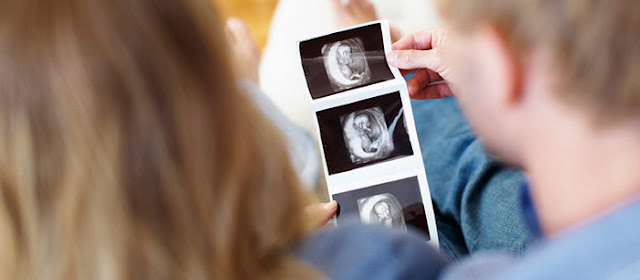 مراحل نمو الجنين أسبوعيا في الثلث الأول من الحمل