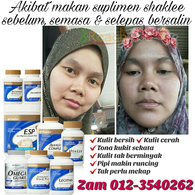 Pengedar Shaklee Bandar Jengka, Pengedar Shaklee Jerantut, Pengedar Shaklee Temerloh, Pengedar Shaklee Pahang