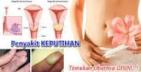 Resep/Obat Organ Kewanitaan Menjadi Rapet,Kencang dan Wangi