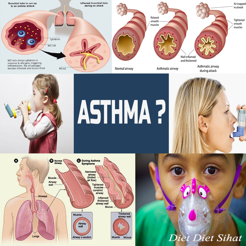 Jihajumi: RAWATAN ASMA (ASTHMA)