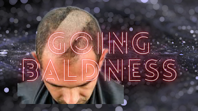 Decrease Going Bald