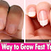 Top 10 Best Way to Grow Nails Faster - Boost Your Fingernails Fast