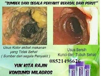 KENAPA USUS ANDA HARUS DI BERSIHKAN DENGAN MILAGROS ?