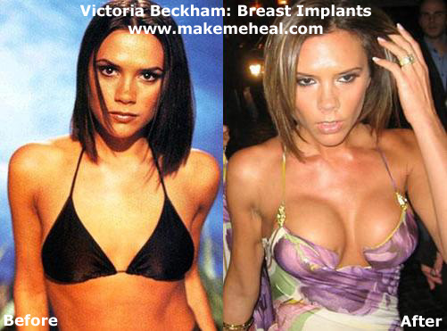 Who didn't know Victoria Beckham? Those who didn't probably just arrived 