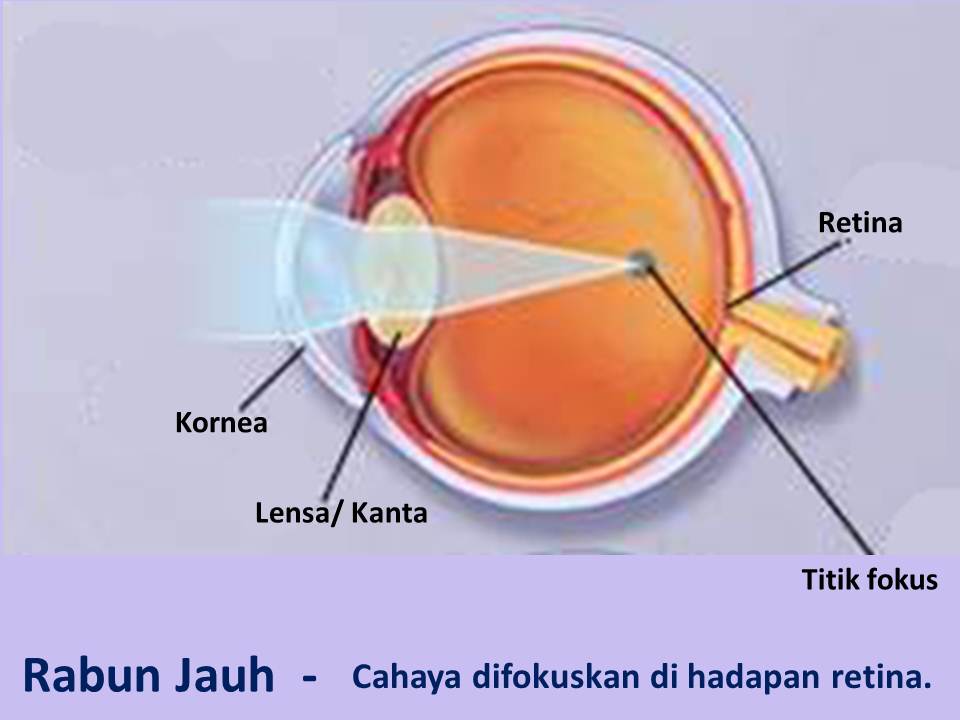 Mengenal Rabun Jauh Rabun Dekat Rabun Tua dan Rabun 