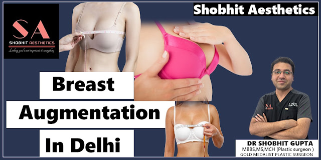 breast augmentation Delhi