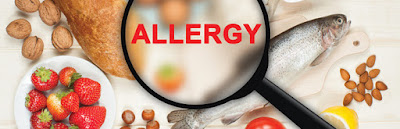 food allergies